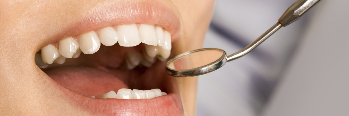 Care sunt serviciile stomatologice de care puteți beneficia cu încredere, pentru orice problemă dentară